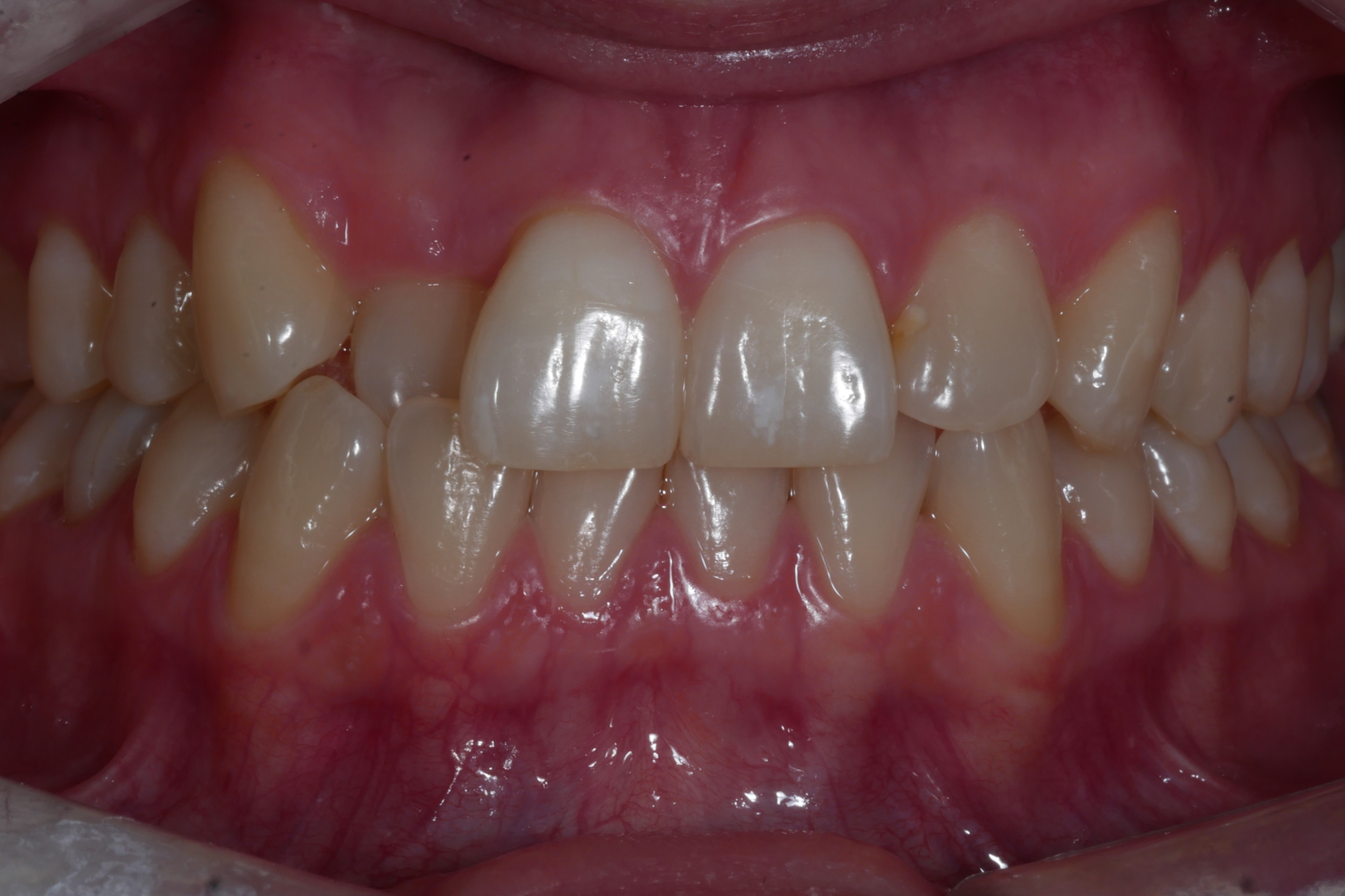 After